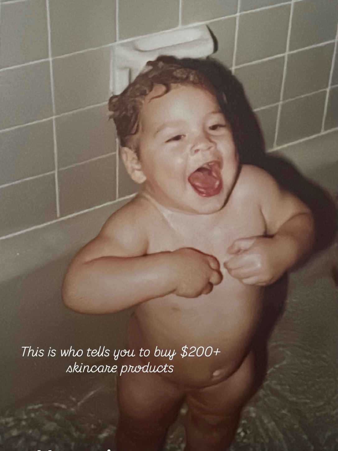 The little girl Erin would be so proud of today. 
Thank you all of your support with the growth of Skyn by EB to know 𝓢𝓴𝔂𝓷 𝓔𝓼𝓽𝓱𝓮𝓽𝓲𝓬𝓼 

#oldpictures #igchallenge #skynesthetics #skynbyeb