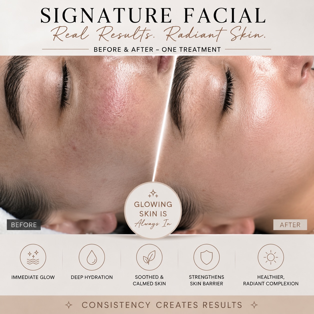 ✨ One Signature Facial. Real Results.
This glow is after just one treatment—but the best results come with consistency.
🤍 Deep hydration
🤍 Healthier skin barrier
🤍 Radiant glow
That’s why we created our Summer Local Love Package ☀️
✨ 3 Signature Facials for $489
✨ Save $50
✨ Packages expire September 30, 2026
Consistency creates results.
📲 DM us or book online to reserve yours.
#skynesthetics #skincare #facials #consistencywins #consistencyiskey